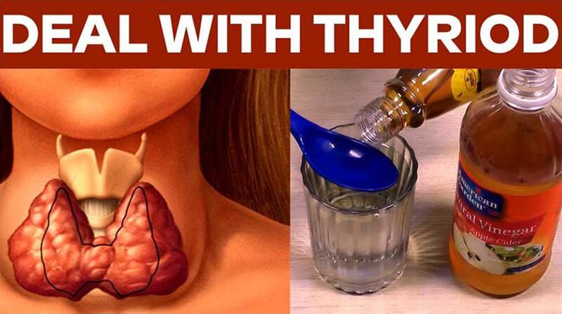 Apple cider vinegar and thyroidism