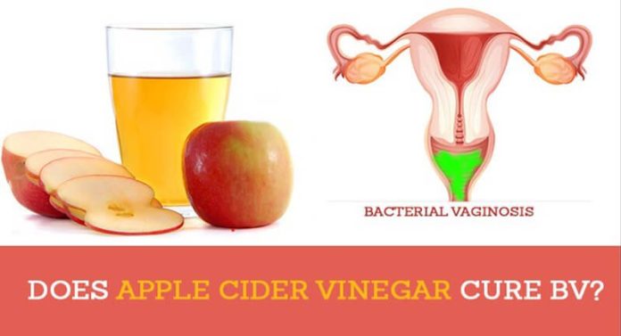 Does Apple Cider Vnegar Cure BV