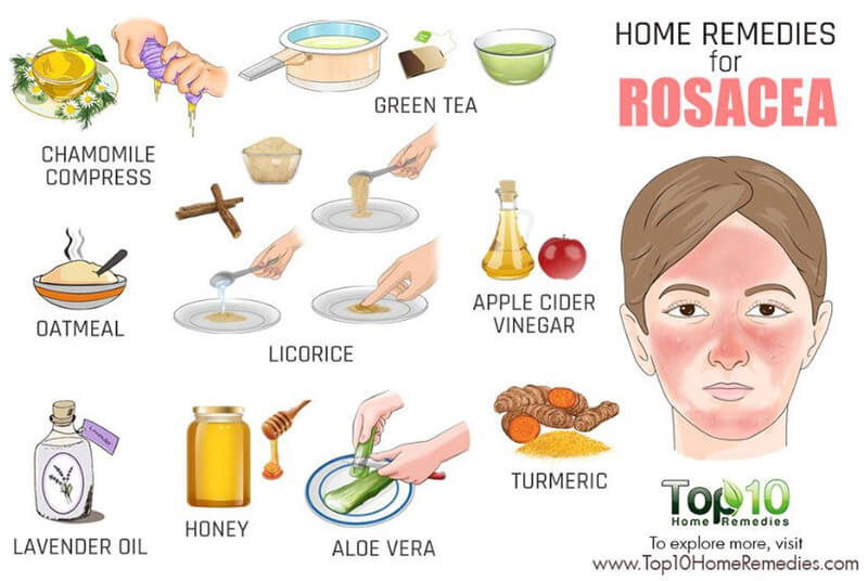 Natural Remedies for Rosacea