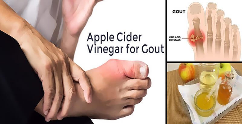 PH amounts and effects for gout