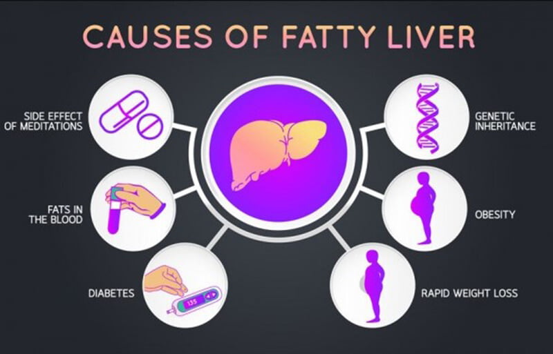 The two main types of fatty liver disease