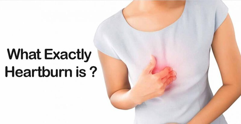 What is heartburn