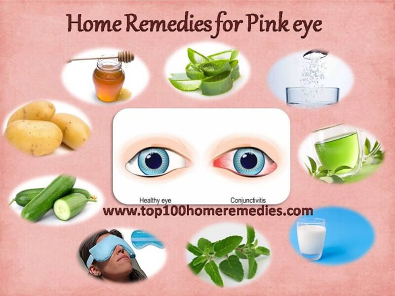 home remedies for pink eye