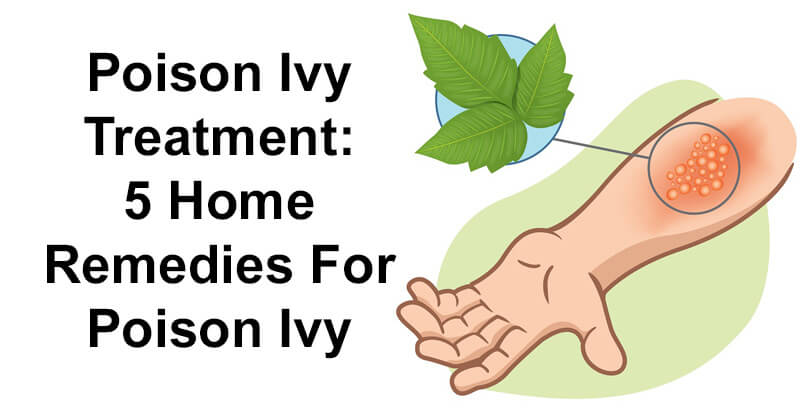 poison ivy rash treatments
