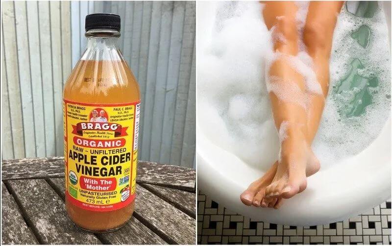 10 Reasons Why You Need To Begin Taking Apple Cider Vinegar Baths