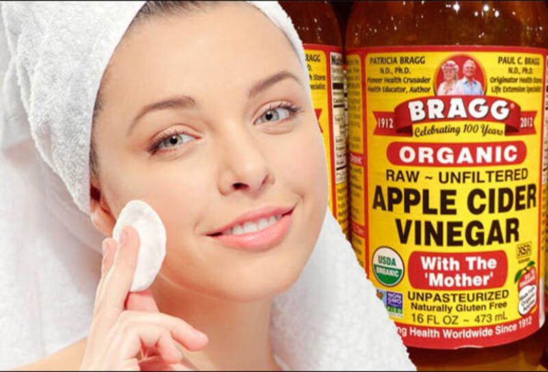 Can You Use Apple Cider Vinegar For Acne