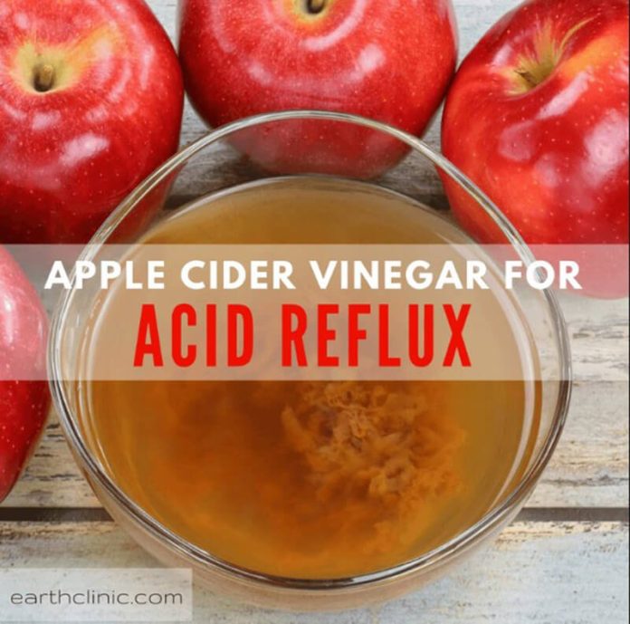 Do Apple Cider Vinegar Help With Acid Reflux