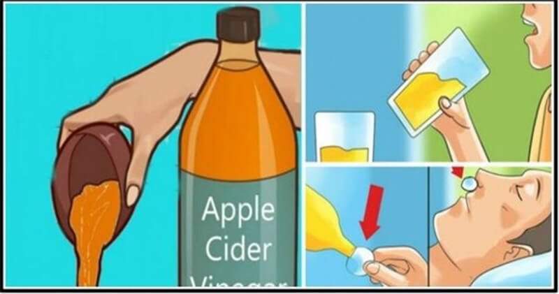 Springplank native Typisch Drinking Apple Cider Vinegar Before Bedtime Will Change Your Life - Ostomy  Lifestyle