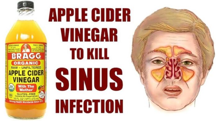 Apple Cider Vinegar For Sinus