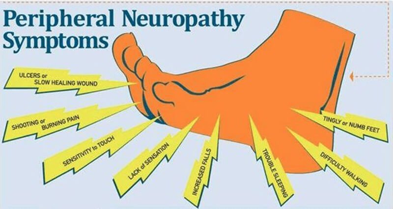 What is peripheral neuropathy
