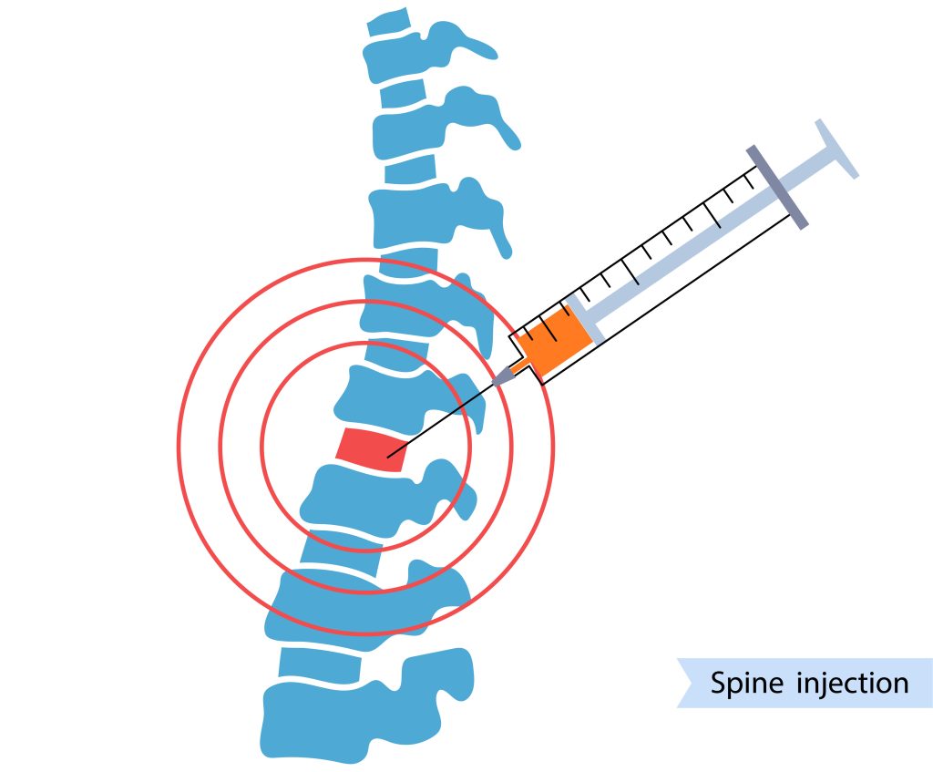 Spine injection