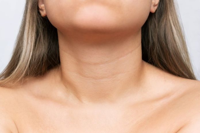 how to get rid of neck lines